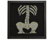 X-ray 4