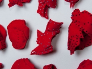 keloids-detail_0