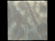 anabaena